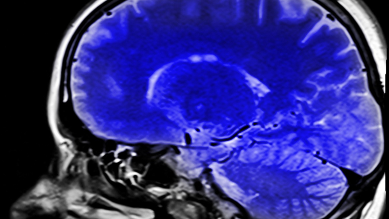 Ученые: мозг может питаться не только глюкозой, но и жирами Исследователи из Weill Cornell Medicine опровер...