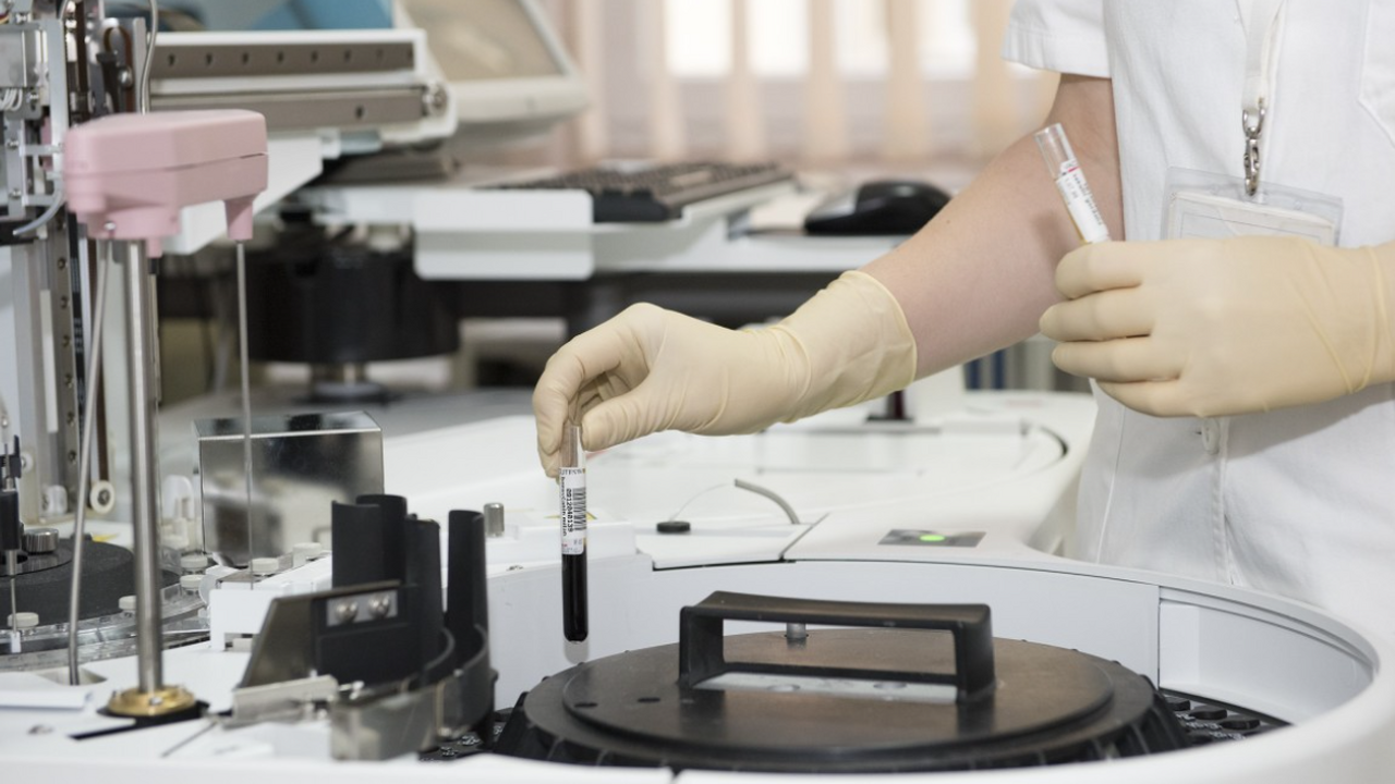 Переливание возрастной крови может ускорять развитие болезни Альцгеймера Исследователи Латиноамериканского института цер...