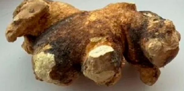 В Симферополе выставили на продажу почечный кам...